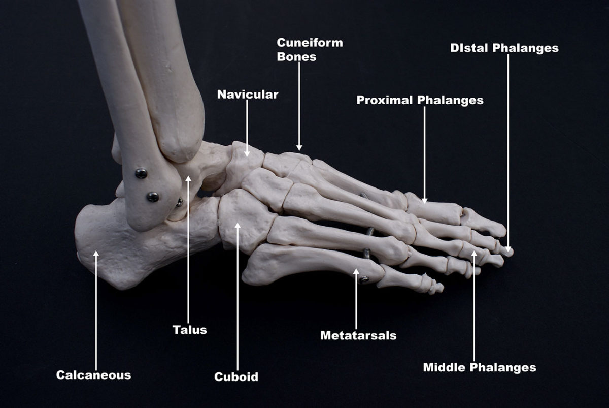 flat feet bone sticking out